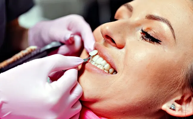 Five Reasons to Choose Dental Veneers in Cary NC